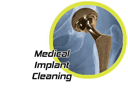solvent free medical implant cleaning with supercritical fluids