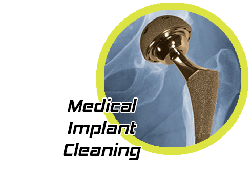 Medical Implant Cleaning